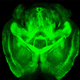 Imagen para el artículo titulado Utilizan tecnología espacial para intentar detectar el Alzheimer